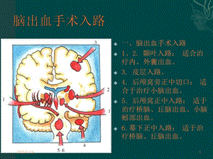 神经外科手术入路课件.ppt