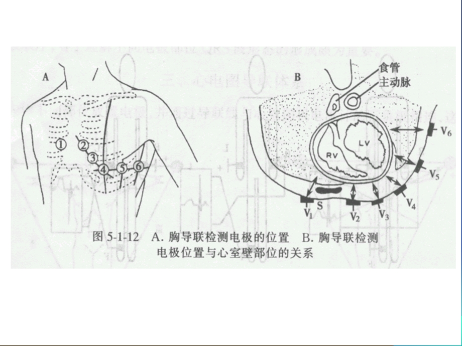 心电图基础知识培训课件.ppt_第3页