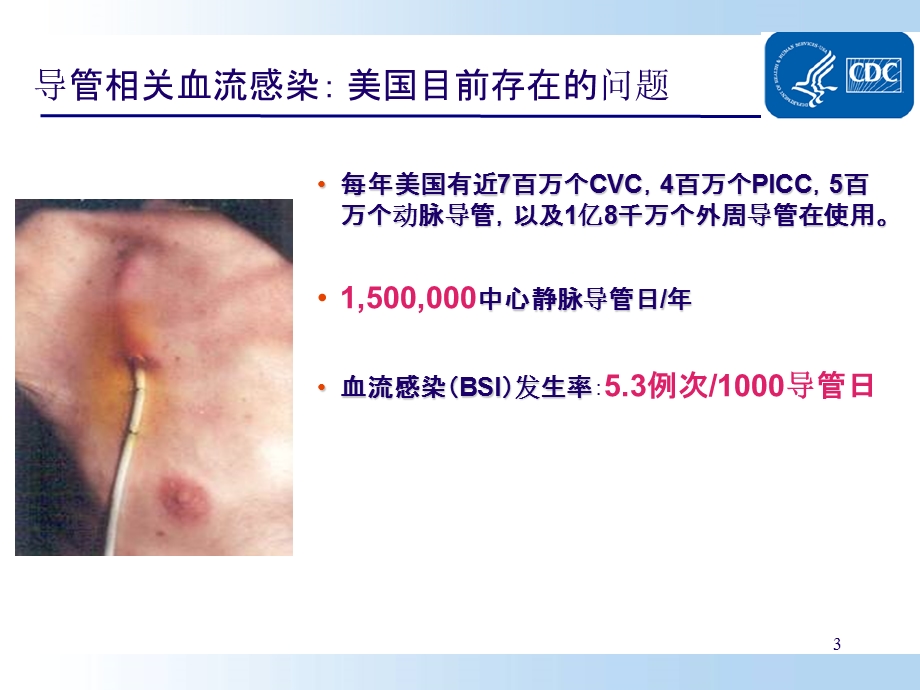 预防导管相关性血流感染(CDC指南解读).. 课件.ppt_第3页