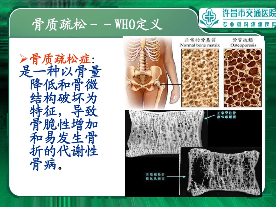 骨科常见病宣传ppt课件.pptx_第2页