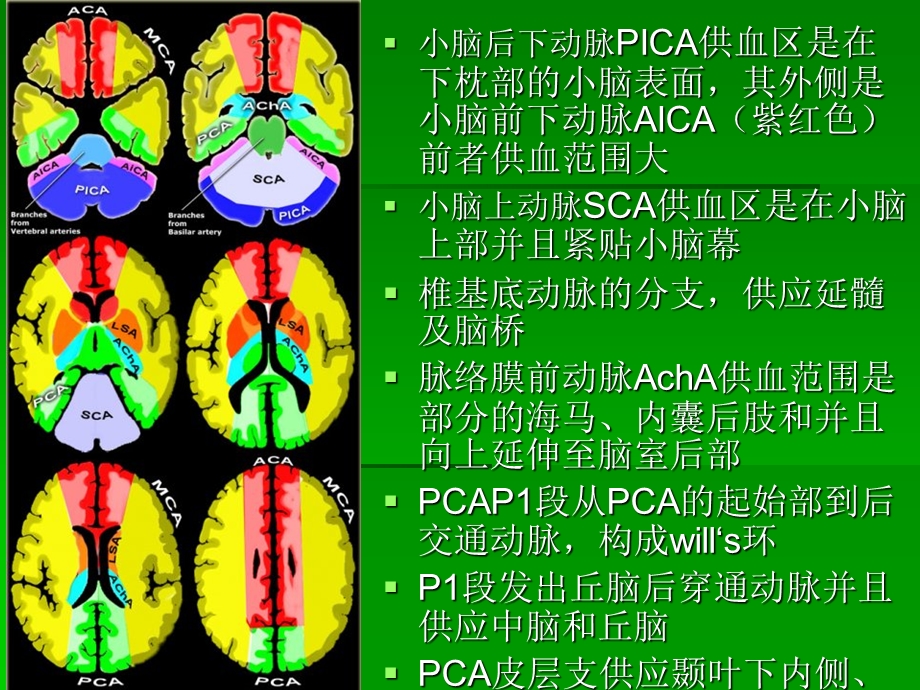 缺血性脑卒中的责任血管课件.ppt_第3页