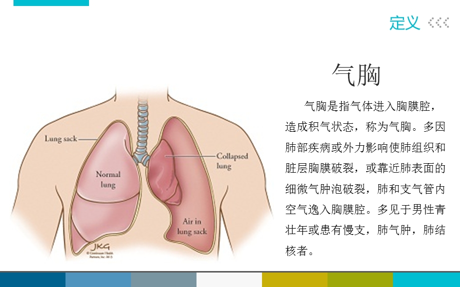 Ⅱ型呼衰合并气胸个案课件.ppt_第3页