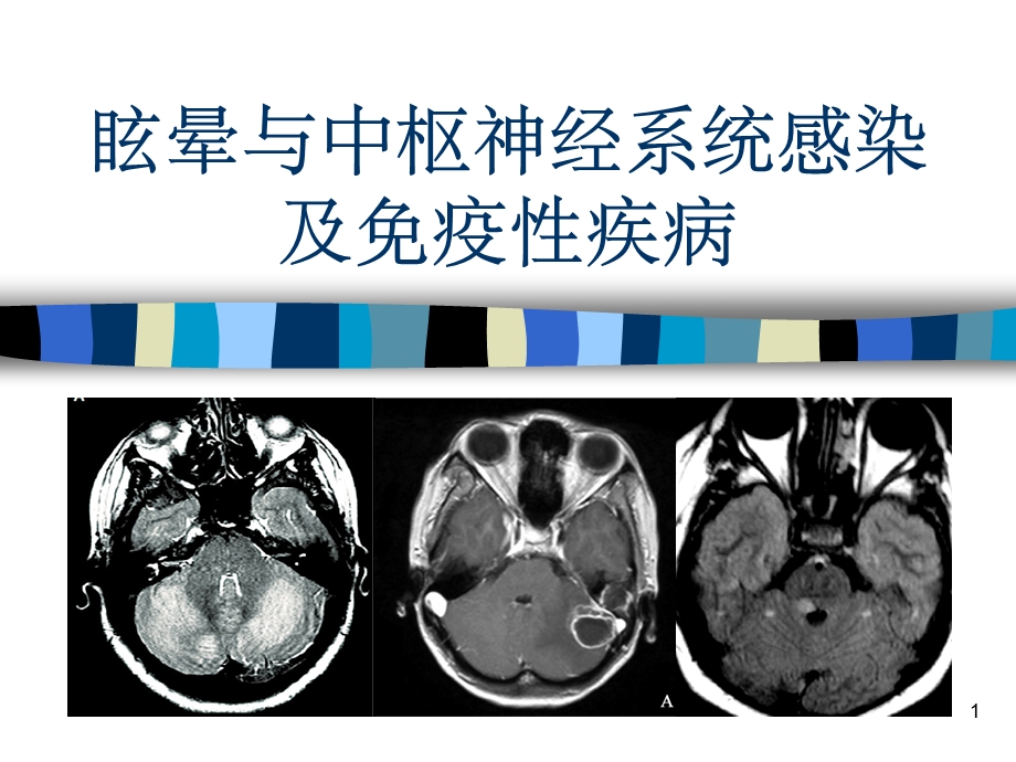 眩晕与中枢神经系统感染及免疫性疾病课件.ppt_第1页