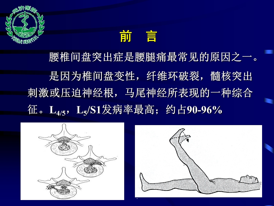 微创手术治疗腰椎间盘突出症课件.ppt_第1页