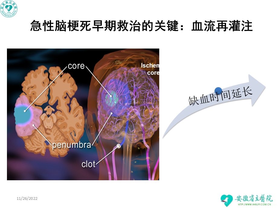 急性脑梗死静脉溶栓指南解读培训——神经内科课件.ppt_第3页