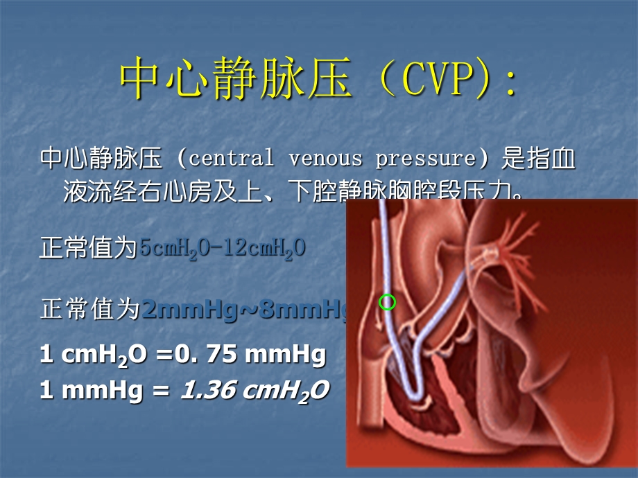 中心静脉压(CVP)监测及波形分析课件.ppt_第3页