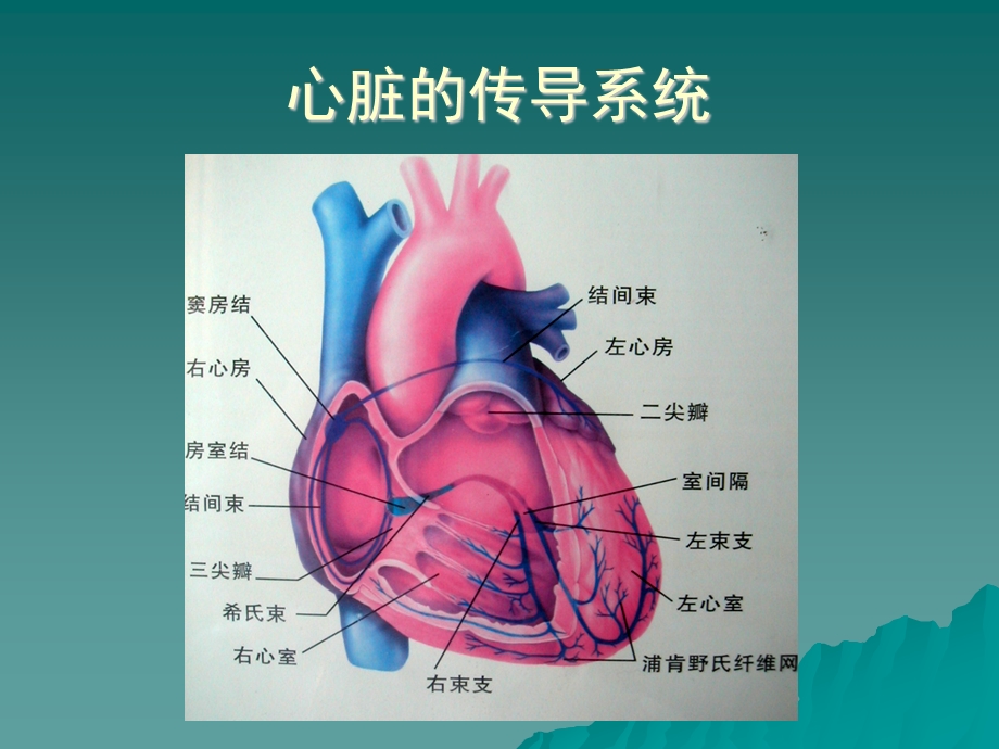 常见心律失常 课件.ppt_第3页