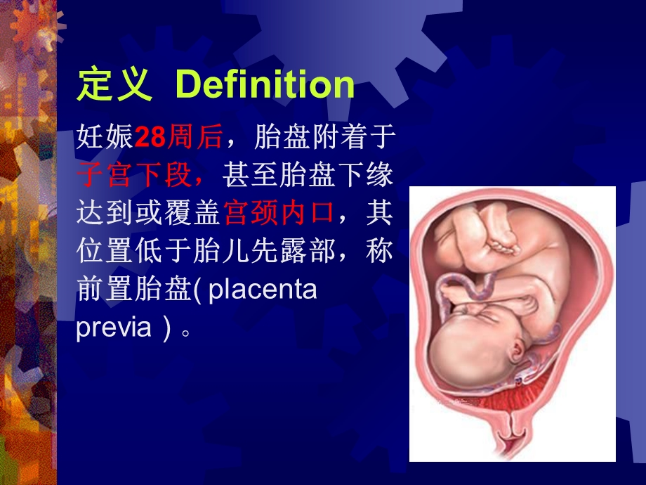 妇产科学精品PPT课件 前置胎盘.ppt_第3页