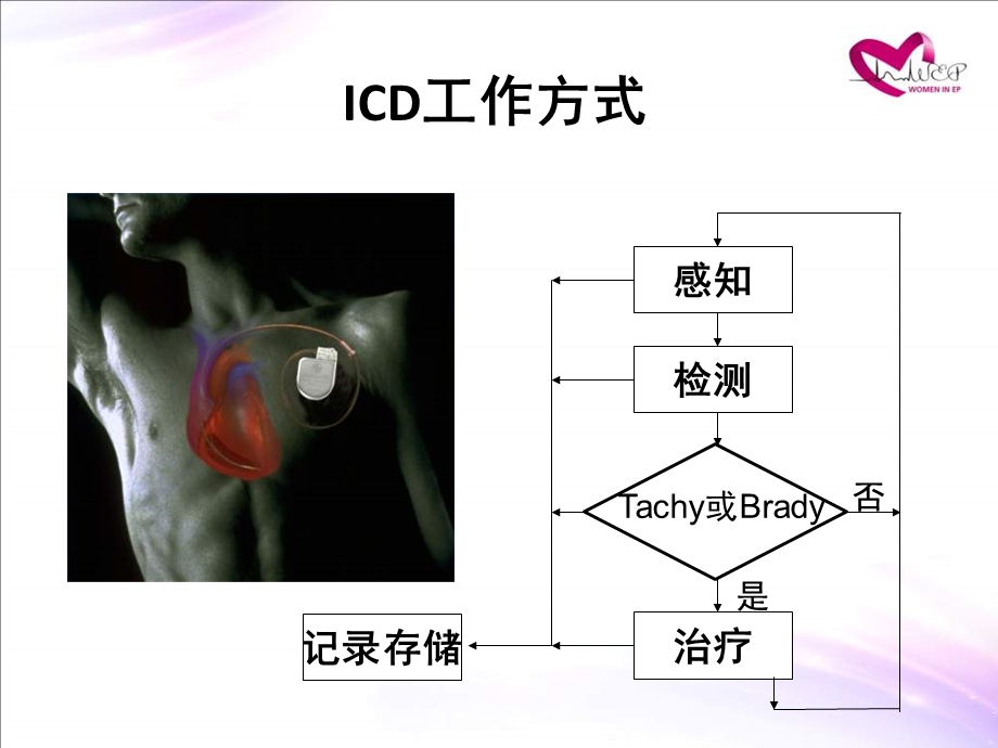 icd的参数设置课件.pptx_第1页