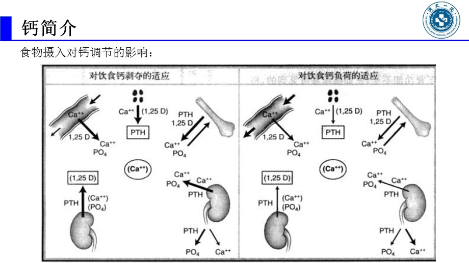 高钙血症 最新完整版本课件.ppt_第3页