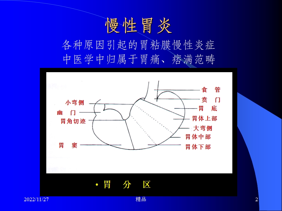 中西医结合 慢性胃炎课件.ppt_第2页