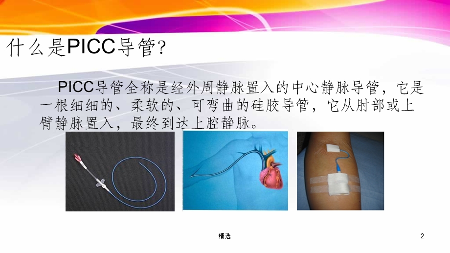 PICC居家护理课件.ppt_第2页