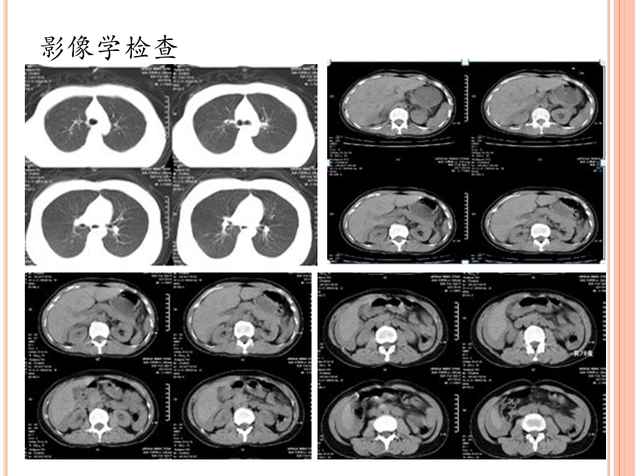 一例严重多发伤大出血病例分享课件.pptx_第3页