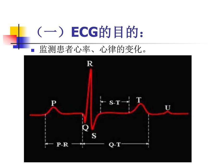 《心电监测技术》课件.ppt_第3页