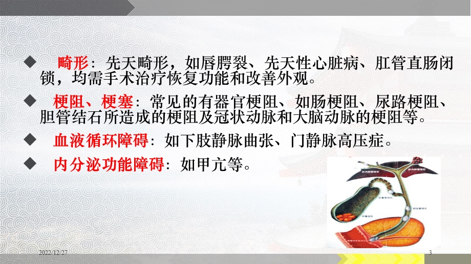 外科护理常规 (精)课件.ppt_第3页