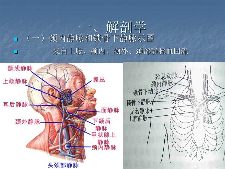 中心静脉穿刺置管详解课件.ppt_第2页