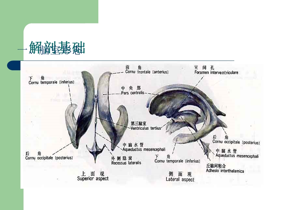 侧脑室穿刺术及脑脊液引流课件.ppt_第2页