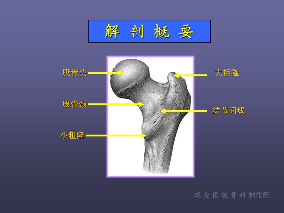 股骨颈骨折 ppt课件.ppt_第3页