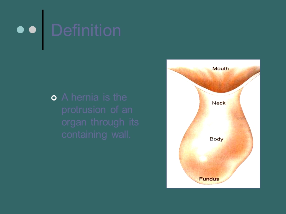 hernia分析PPT课件.ppt_第2页