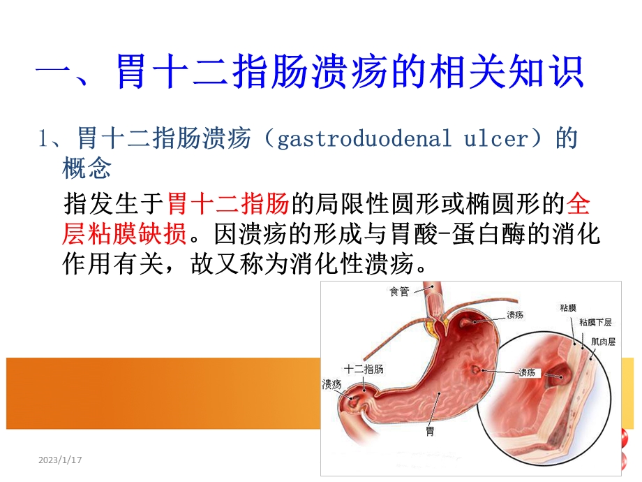 胃十二指肠溃疡病人的 护理课件ppt.ppt_第3页