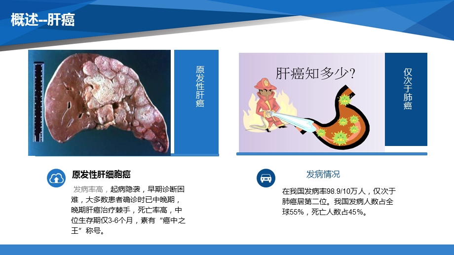 肝癌 靶向治疗的护理课件.ppt_第2页