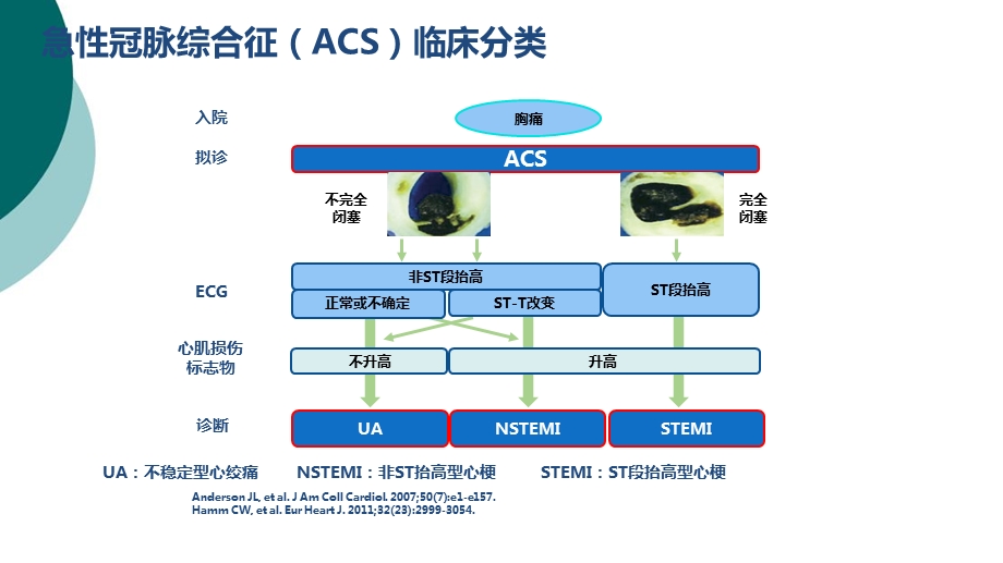 NSTE ACS诊断标准和治疗原则解读课件.ppt_第3页