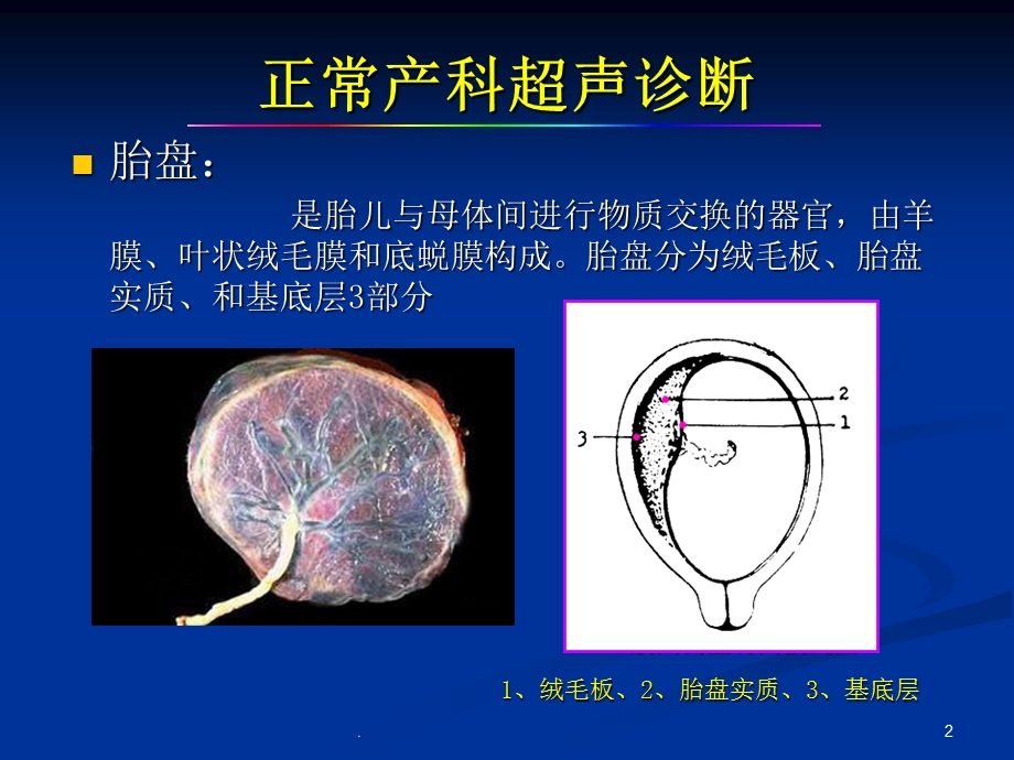 产科急诊超声诊断课件.ppt_第2页