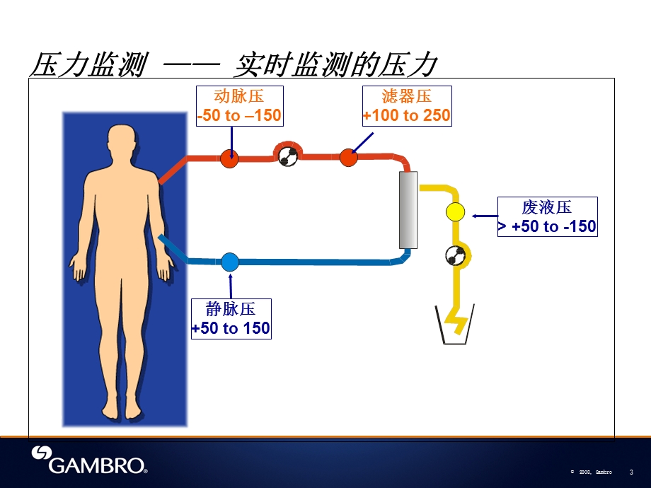 CRRT金宝PrismaFlex常见报警及对策课件.ppt_第3页