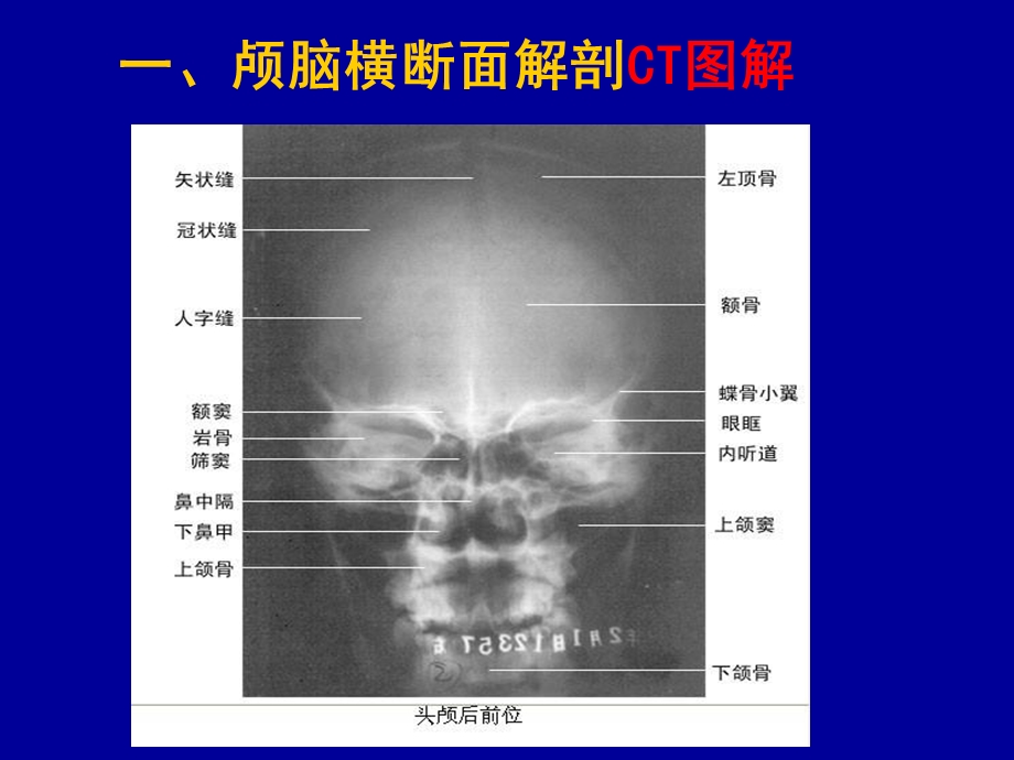 头颈部CT应用课件.ppt_第3页