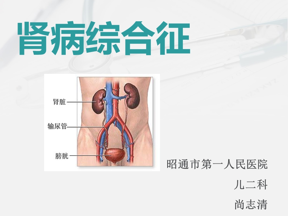 小儿肾病综合征完整版本课件.ppt_第2页