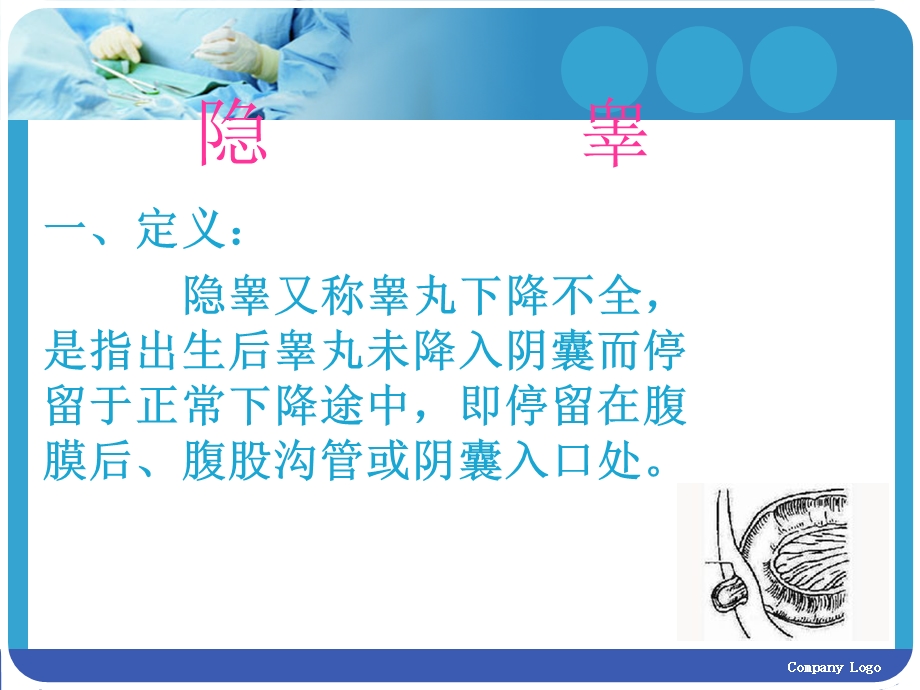 小儿隐睾PPT课件.ppt_第2页