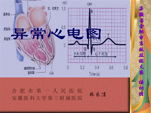 异常心电图课件.pptx