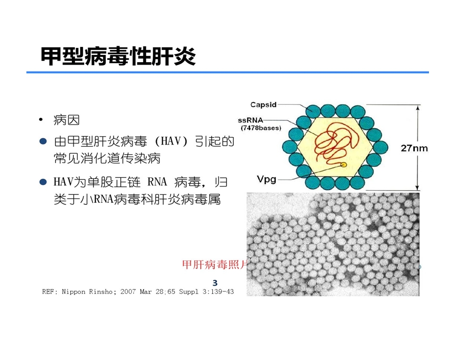 常见肝病预防与治疗课件.ppt_第3页