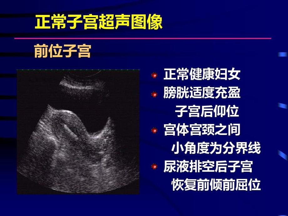 妇科疾病超声检查图谱解析课件.ppt_第2页