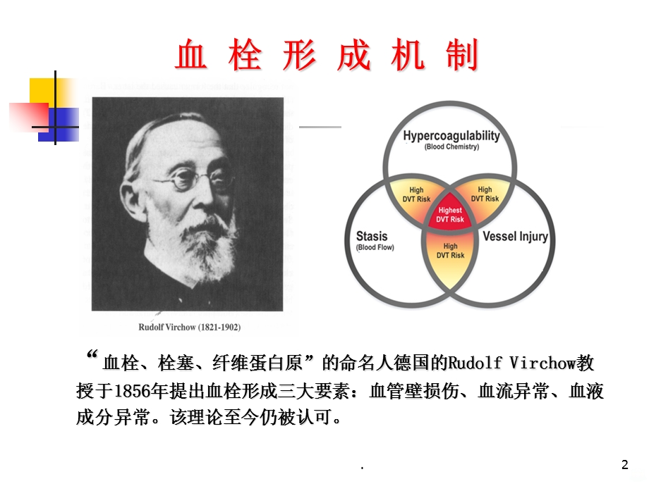 弥散性血管内凝血新课件.ppt_第2页