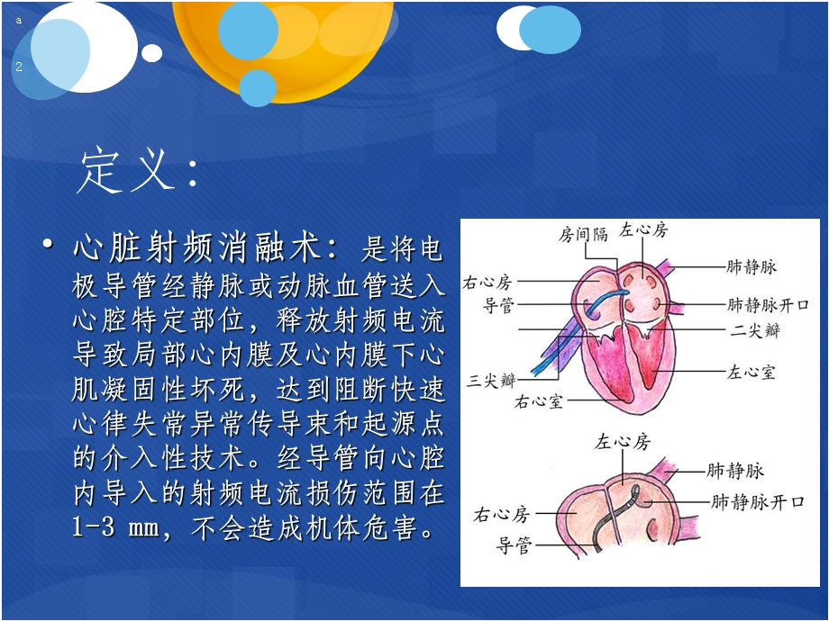 射频消融术术后护理课件.ppt_第2页