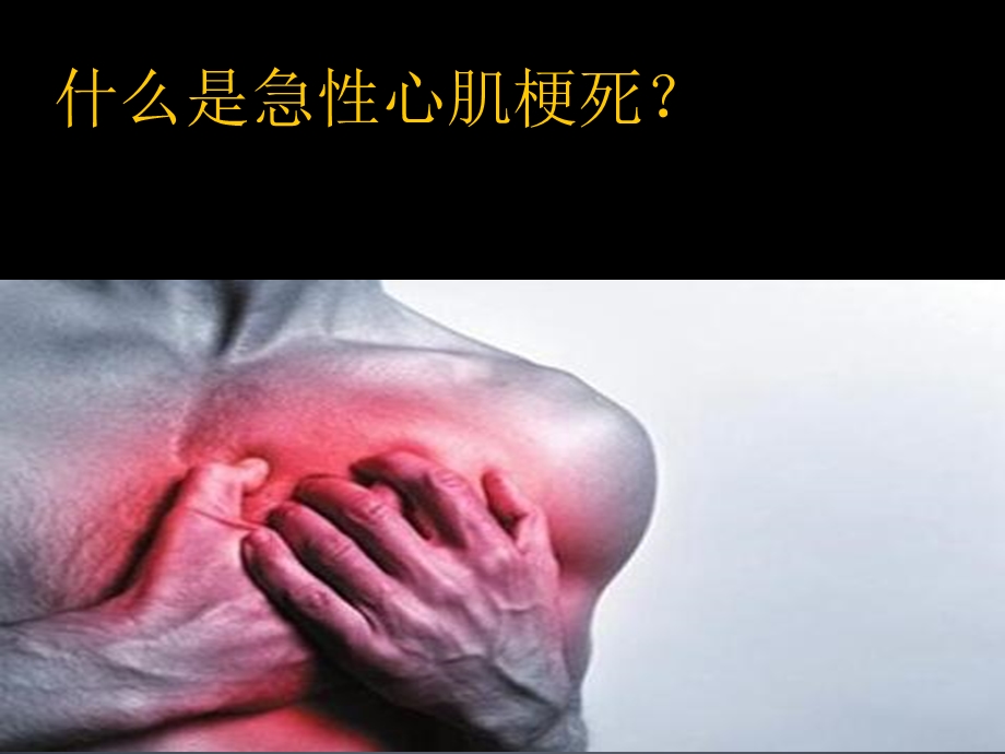 急性心肌梗死的溶栓治疗课件.ppt_第2页