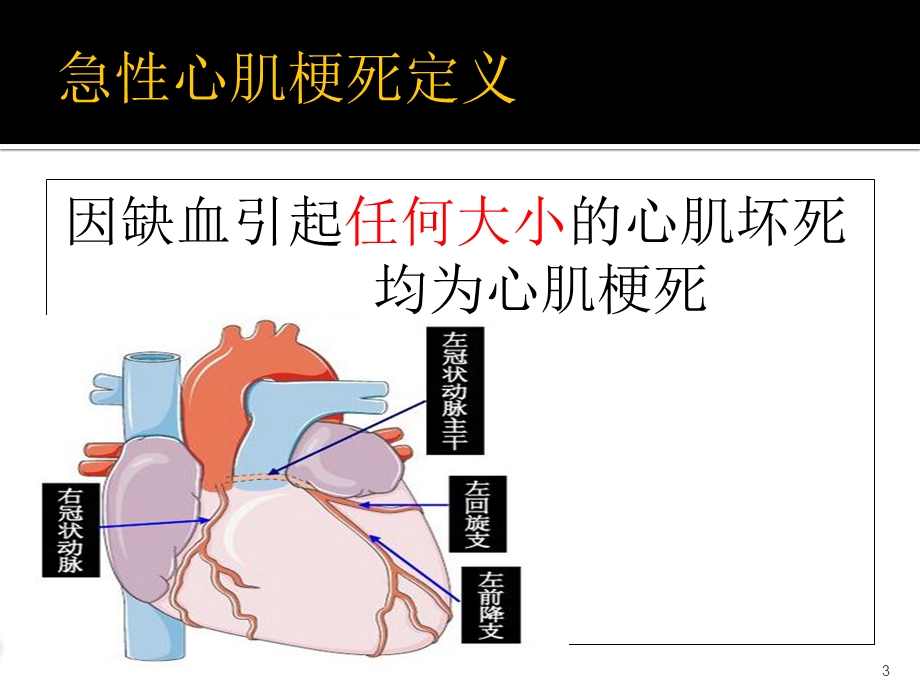 急性心肌梗死的溶栓治疗课件.ppt_第3页