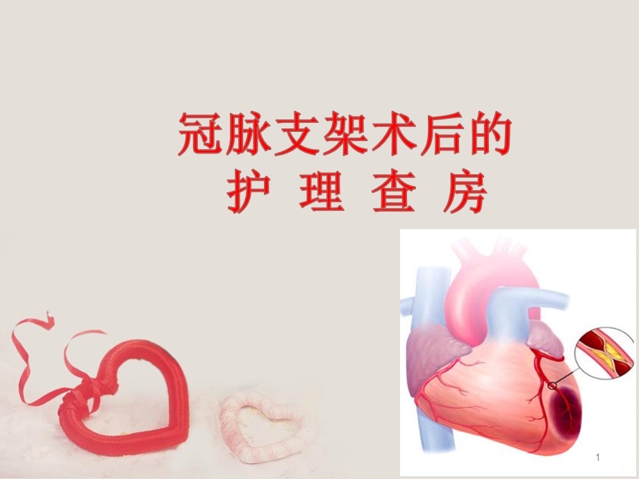 冠脉支架术后护理课件.ppt_第1页