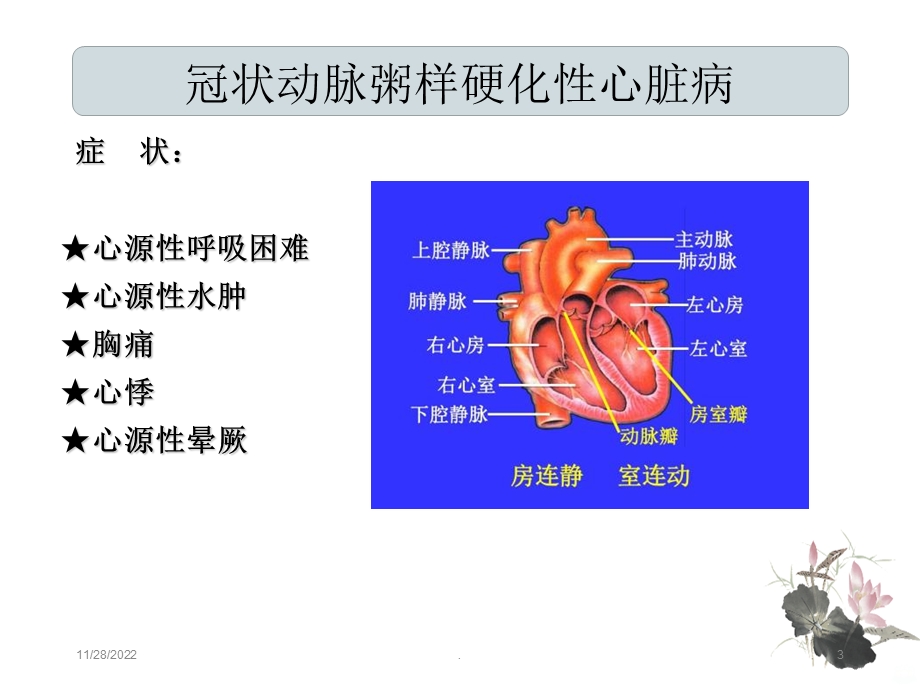 冠状动脉粥样硬化性心脏病护理查房课件.ppt_第3页