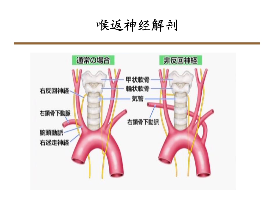 喉返神经解剖技术外科进展课件.ppt_第2页