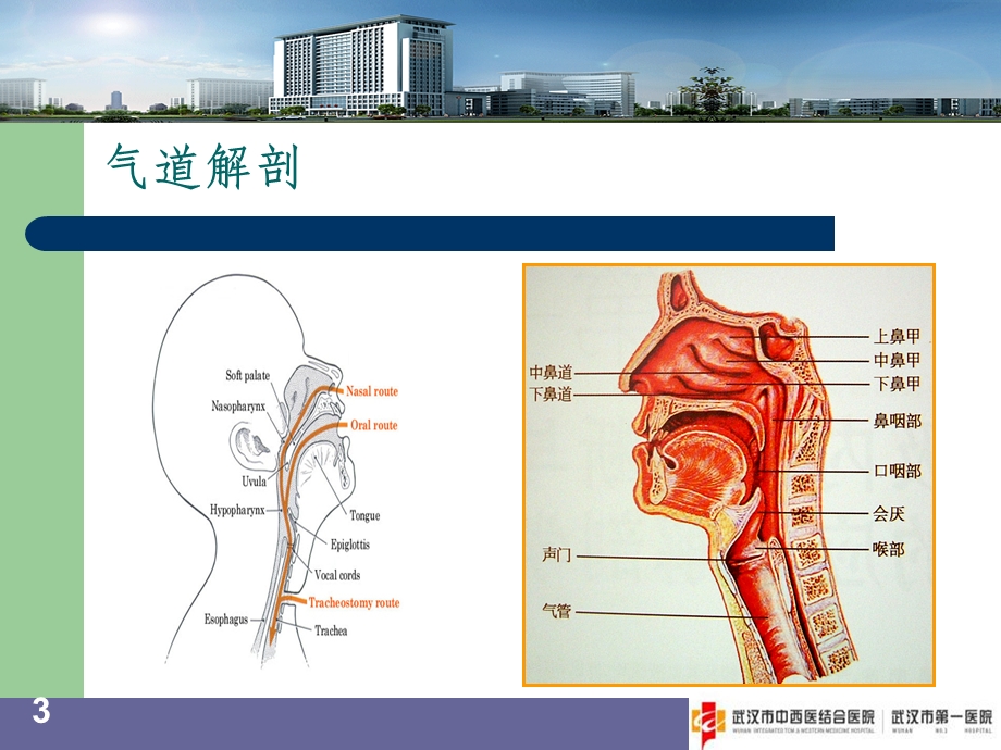 困难气道的评估与处理课件.ppt_第3页