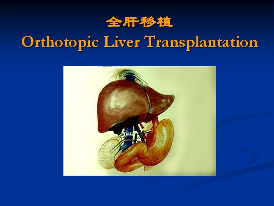 外科学总论之器官移植课件.ppt_第2页