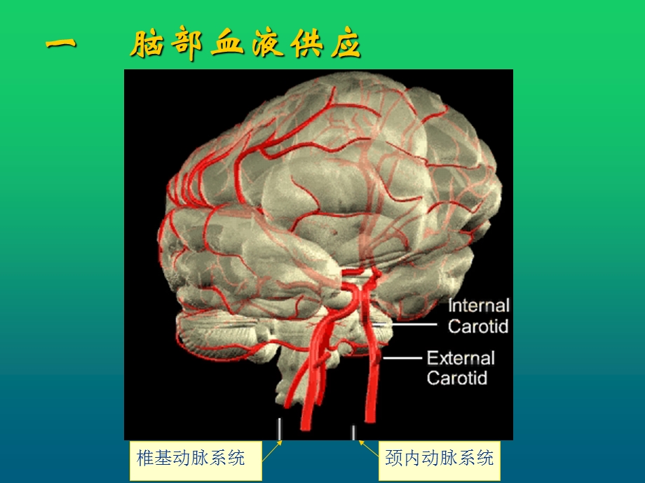 急性脑血管病的诊断及鉴别诊断课件.ppt_第3页