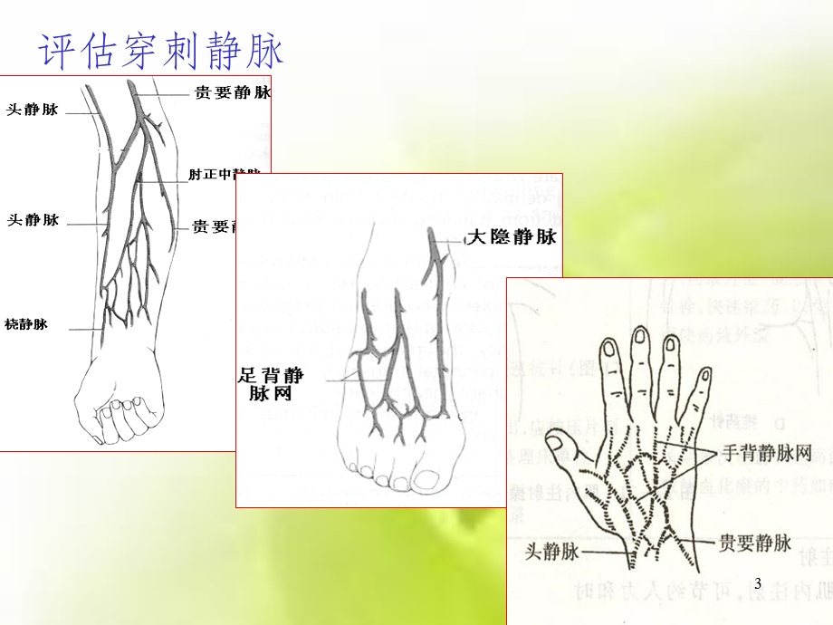 密闭静脉输液技术操作流程课件.ppt_第3页