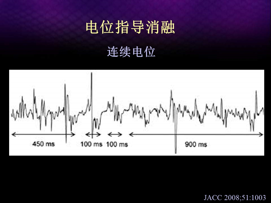 慢性房颤导管消融的技术与评价课件.pptx_第3页