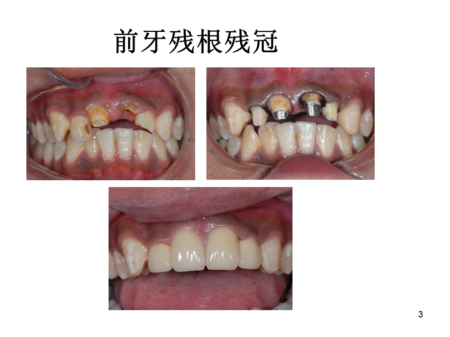 口腔修复医患沟通课件.ppt_第3页