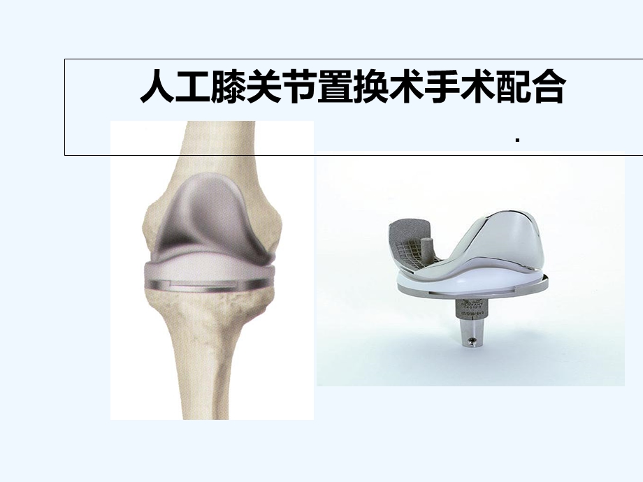 全膝关节置换术课件.ppt_第1页