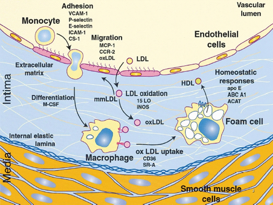 动脉粥样硬化的研究进展课件.ppt_第3页