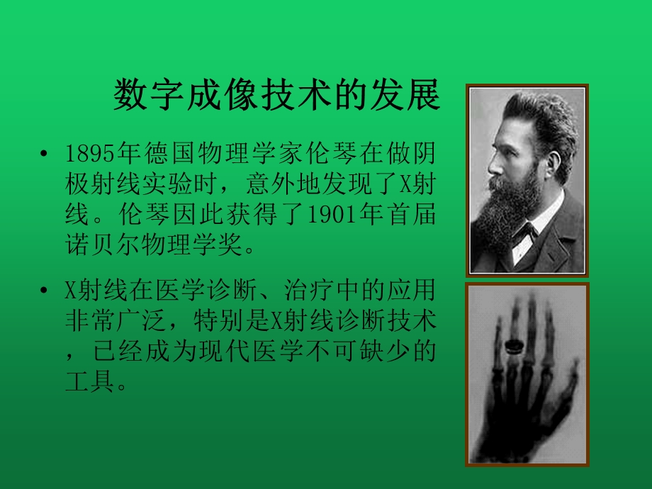 数字化X线检查在儿科中的应用课件.ppt_第2页